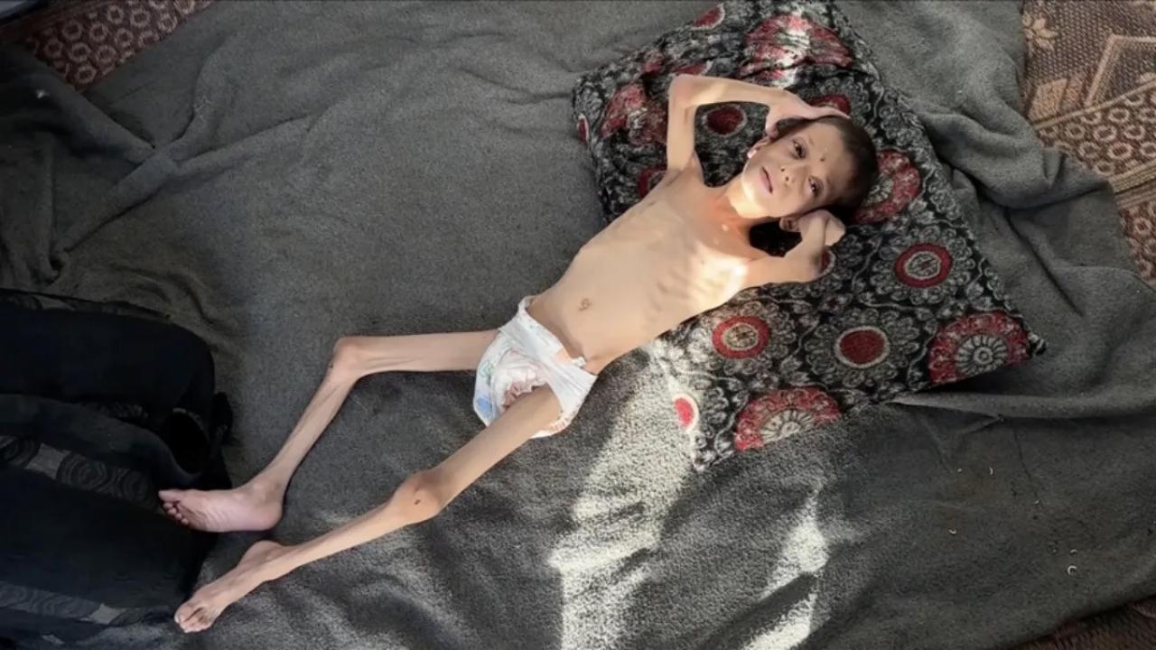 10 yasindaki gazzeli nafiz 4 aylik bebege donustu annesi tasimaya bile korkuyor KG9daPbJ